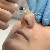 nose surgery procedures