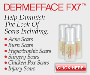 dermefface fx7 product for scar reduction